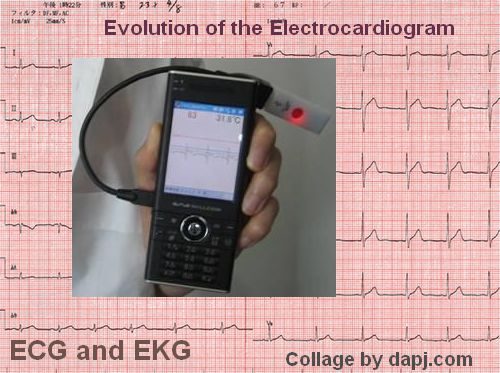 electrocardiogram-ecg-ekg
